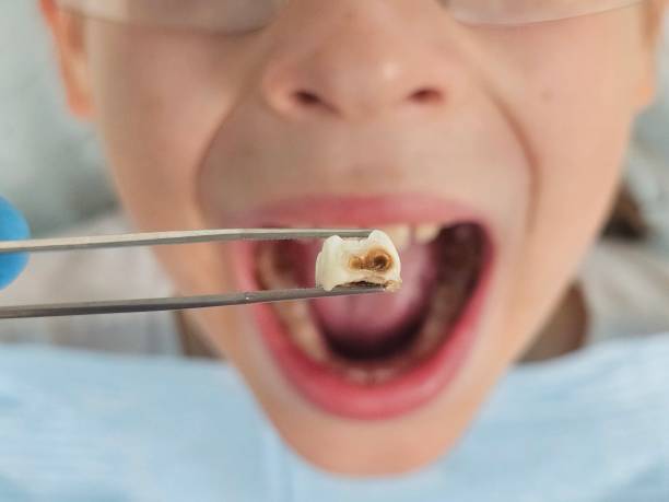 Best Emergency Gum Treatment in Woodruff, SC